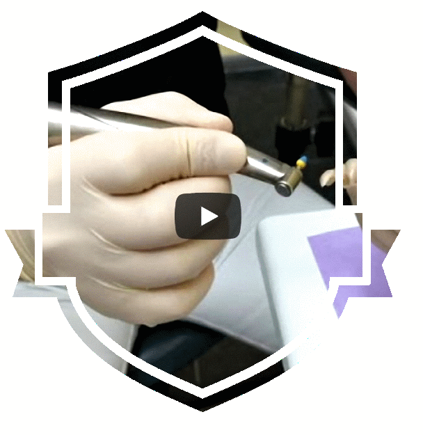 Politur einer Cerec-Vollkeramik