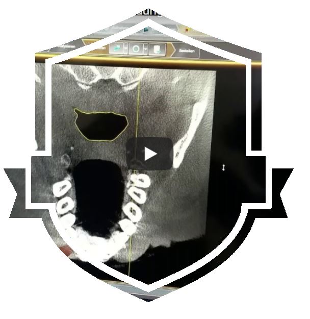 DVT-Befundung mit Sicat Air (Sicat Suite)