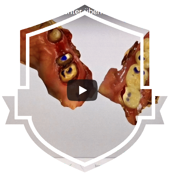 Cerec-Konstruktionen mit Connect-Case-Center übermitteln