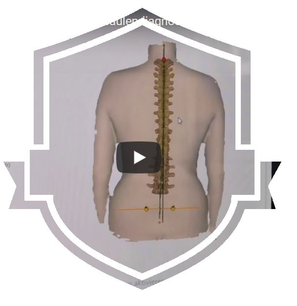 Kaukraftableitungsstörung und deren orthopädische Auswirkungen